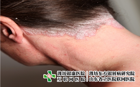 攝圖網_327944171_嚴重皮絲蟲病     頸部（企業(yè)商用）