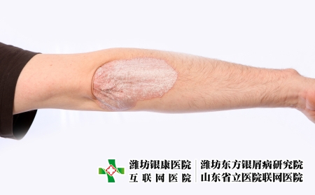 攝圖網(wǎng)_327921215_微絲蟲病藥物皮膚濕疹疾病人體皮疹皮炎痛苦燒傷醫(yī)生（企業(yè)商用）