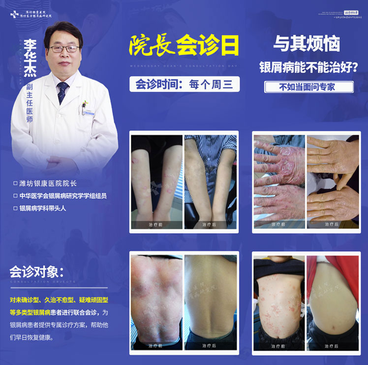 濰坊皮膚病醫(yī)院周三院長會診日